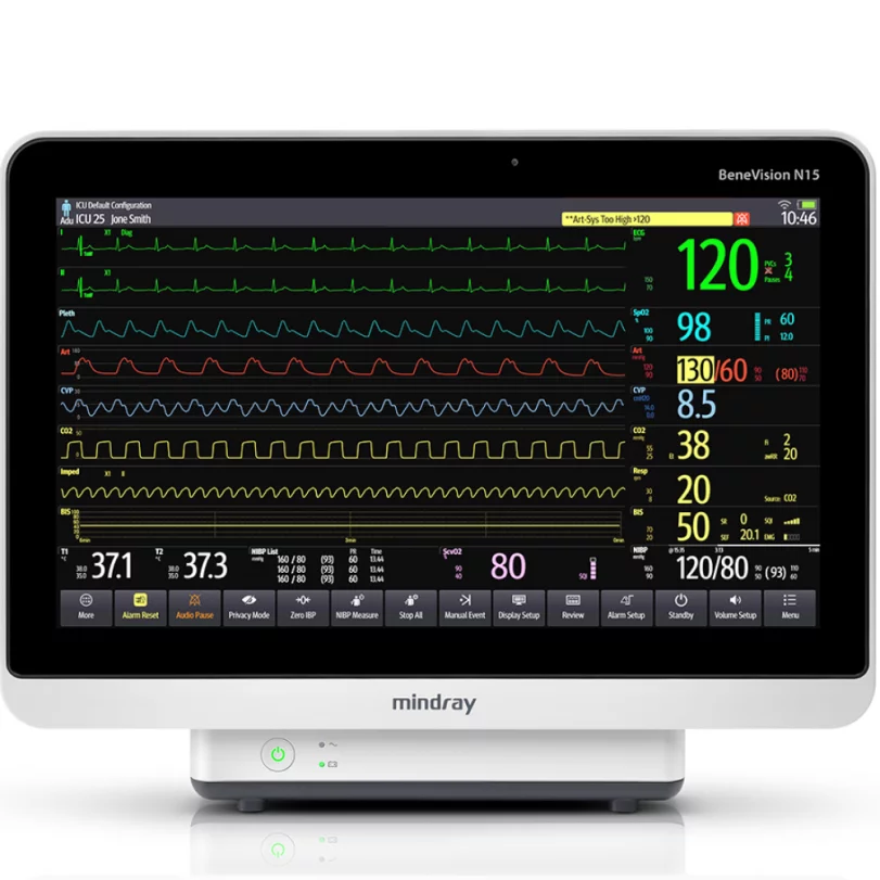 Монитор пациента Mindray Benevision N15