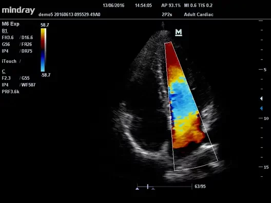 Ультразвуковой сканер Mindray M6