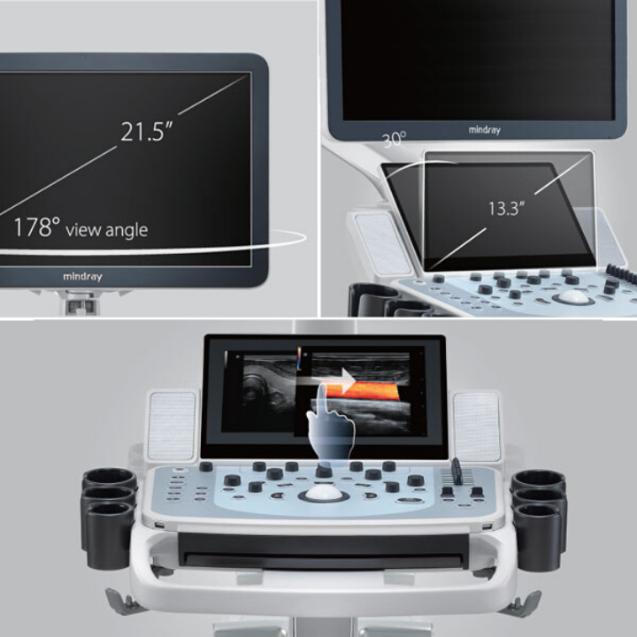 Ультразвуковой сканер Mindray DC-60 Pro