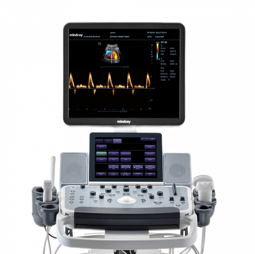 Ультразвуковой сканер Mindray DC-55